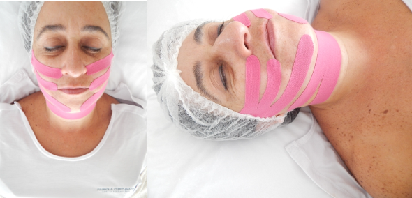Novo protocolo Lipotaping representa o conceito da área dermatofuncional para melhorar a firmeza e contorno facial